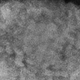 An electron microscope image of a single monkeypox virus.